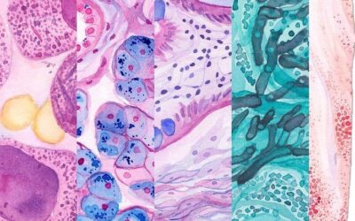 مدخل إلى علم الأمراض التشريحيIntroduction to Anatomic- Pathology